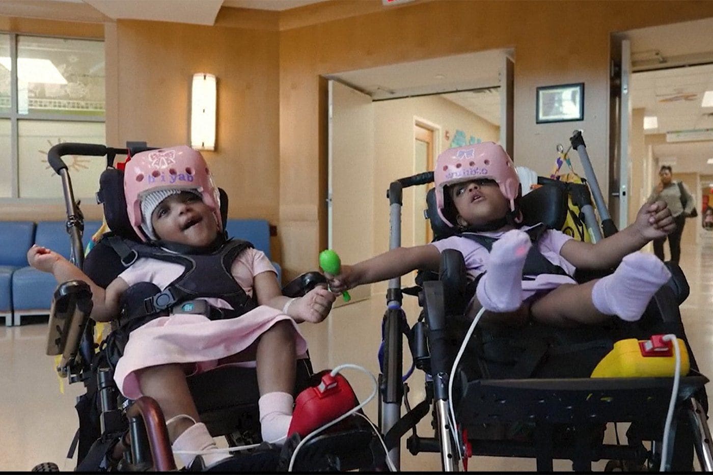 Doctors successfully separate conjoined twins after 25-hour surgery in Missouri